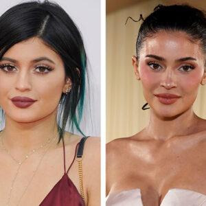 The Mirror of Perfection: 17 Hollywood Icons and the Great Plastic Surgery Debate